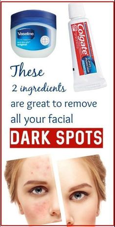 Use Colgate and Vaseline to Get Rid Of Dark Spots On The Face Spots On Skin, Face Cleaner, Dark Rings, Dark Spots On Face, Glowing Skin Mask, Brown Spots On Face, Skin Shine, Dark Spots On Skin