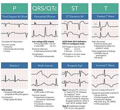 Cath Lab Nursing, St Elevation, Pericardial Effusion, Paramedic School, Nursing Information, Nursing School Essential, Cardiac Nursing, Posts On Instagram, Nursing School Survival