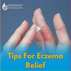 Discover effective strategies and top products to soothe and manage eczema⭐
#eczema #preventiontips #indore #drabhishekmalviya #dermatologist Home Redesign, Skin Doctor, Laser Clinics, Skin Clinic, Best Skin, Mens Skin Care, Post Workout, Radiant Skin