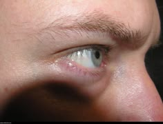 a close up of a man's eye with the reflection of another person in the background