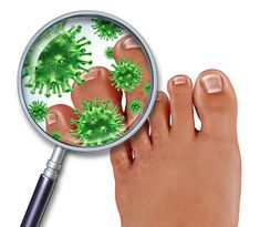 The best natural remedies for toenail fungus including Dietary Modifications, Home Remedies, Ayurvedic Remedies, and Essential Oils | Acrylic Nails Natural, Peroxide Uses, Hydrogen Peroxide Uses, Toenail Fungus Remedies, Fungal Nail, Ayurvedic Remedies, Athletes Foot, Toenail Fungus, Fungal Infection Green Toes, Tinea Pedis, Peroxide Uses, Hydrogen Peroxide Uses, Myrrh Essential Oil