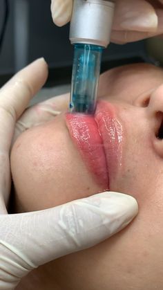 Hidragloss Lip, Hydrafacial Videos, Bb Lips, Dermapen Microneedling, Facial Massage Techniques, Medical Esthetician, Botox Lips, Bb Glow, Eyebrow Design