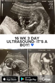 an image of the side of a person's stomach with text that reads 16 wk 3 day ultrasound - it's a boy