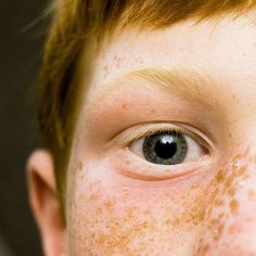 a young boy with freckles on his face