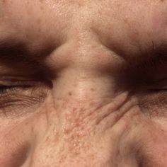 a man's face with wrinkles on his forehead and eyes, close up