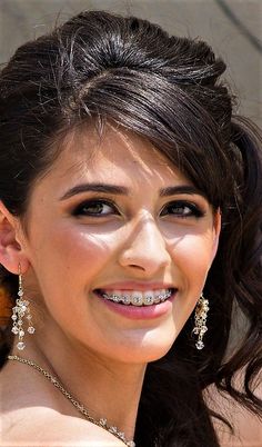 Celebrities With Braces, Braces Colors Ideas, V34 Colour Corrector, Colour Corrector, Orthodontic Appliances, Health Aesthetic