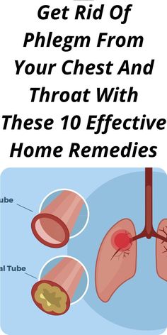 Get Rid Of Phlegm From Your Chest And Throat With These 10 Effective Home Remedies Getting Rid Of Mucus, Chest Congestion Remedies, Congestion Remedies, Getting Rid Of Phlegm, Home Remedies For Bronchitis, Best Cough Remedy, Sick Remedies, Chest Congestion, Home Remedy For Cough