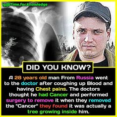 a man with an x - ray behind him and the caption that says did you know?