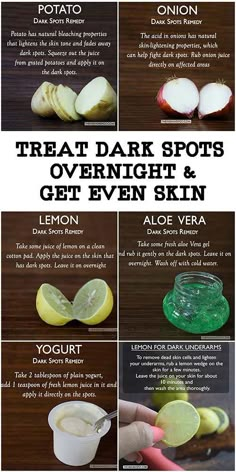 Dark Spots Remedies, Fresh Aloe Vera Gel, Black Heads, Brown Spots Removal, Resep Diet, Skin Spots, Beauty Tips For Glowing Skin, Baking Soda Shampoo, Cold Remedies