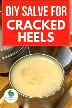 Cracked Heels Remedy, Cracked Heels Diy, Homemade Salve Recipes, Diy Salve, Cracked Heel Remedies, Homemade Salve, Dry Cracked Heels, Salve Recipes, Diy Deodorant