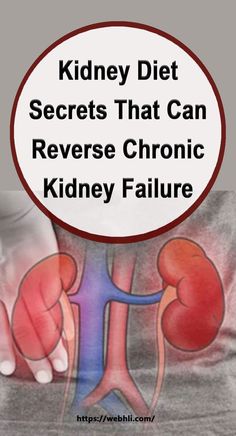 Renal Friendly Recipes, Kidney Healthy Foods, Healthy Kidney Diet, Renal Diet Recipes, Healthy Kidneys, Kidney Diet, Renal Diet, Chronic Kidney, Natural Health Care