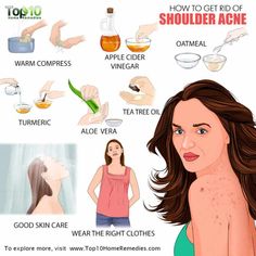 Body Acne Remedies, Shoulder Acne, Back Acne Remedies, Chest Acne, Pimples Under The Skin, Top 10 Home Remedies