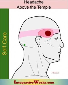 Self-care, headache spot above temple, sometimes with a band around head. Quick relief, stretches for lasting relief. Yoga poses. More. Temple Headache, Anatomy Medical, Headache Types, Tension Headache, Self Massage, Headache Relief, Acupressure Points