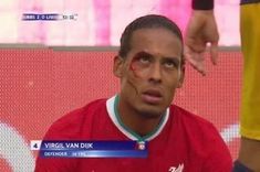 a man with blood on his face sitting in front of a soccer player's head