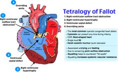 an image of the anatomy of the heart