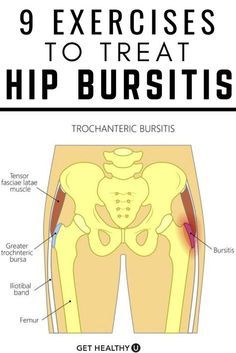 Bursitis Exercises, Best Exercise For Hips, Bursitis Hip, Hip Pain Relief, Lower Back Pain Exercises, Health And Fitness Articles, Hip Pain, Hip Workout