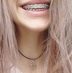 Black Braces, Braces Tips