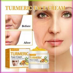 Turmeric Firming Skin Cream Wrinkle Reducing Cream 50g Dry Skin Tightening Women's Line Wrinkle Firming And Antis Aging Cream Features: Yellow Firming Skin : This is a perfect moisturizing firming skin for the face. It provides women with powerful -aging, wrinkle reduction, face lift and firming. -Wrinkle for Women's Face: This is an -wrinkle lotion for women that visibly relieves rough skin, provides a nice smoothing effect, reduces wrinkles, reduces signs of aging, and helps you have a truly stunning face. Creams supported by natural plants: Does this -aging contain collagen, , and vitamin E to help the face, this not deeply hydrates, but also locks in -into the night. Day and Night : This -wrinkle has powerful moisturizing and repairing ingredients, suitable for women of any age and any Dark Spot Corrector Serum, Organic Face Cream, Turmeric Face, Dark Spot Corrector, Serum Cream, Brighten Skin Tone, Anti Aging Serum, Anti Aging Cream