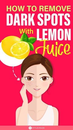 Discover the brightening benefits of lemon juice for reducing dark spots on your skin. This guide provides step-by-step instructions on how to safely use lemon juice, including application methods and tips for best results. Learn how to incorporate this natural remedy into your skincare routine for a more even complexion! Apple Cider Vinegar For Skin, Dark Spot Remover, Dark Spots On Face, Spot Remover, Apple Cider Benefits, Dark Spots On Skin, Brightening Skin, Skin Spots, Spots On Face