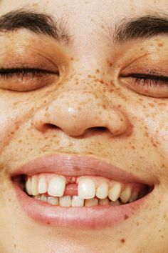 a close up of a person with freckles on their face