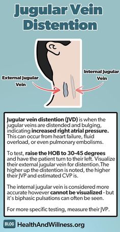 the diagram shows how to use an inhaler for vagination and other medical devices