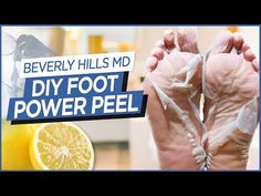 This DIY pre-summer power foot peel will have your feet summer ready in no time, and the recipe is easy to make right at home! No store product necessary. Foot Mask Diy, Foot Mask Peel, Cracked Heel Remedies, Diy Foot Soak, Foot Soak Recipe, Feet Remedies, Foot Soaks, Cracked Heel, Peeling Mask