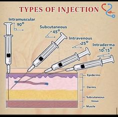 Types Of Injections Nursing, Injection Types, Pharmacy Study, Types Of Injection, Microbiology Notes, Medical Lab Technician, Nurse Skills