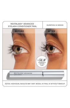 What it is: A finely calibrated, scientifically driven cosmetic eyelash serum developed to address the visual signs of eyelash aging and stress.What it does: This eyelash serum features the company’s proprietary Biopeptin™ Complex, a breakthrough cosmetic technology. Combined with potent antioxidants and fortifying amino acids, it works in concert to enhance the beauty and create the impression of iconic-looking lashes.Features and benefits:- Conditions the eyelashes to help protect from brittle Eyelash Conditioner, Eye Infections, Eyelash Serum, Improve Flexibility, Dry Eyes, Irritated Skin, Amino Acids, Eyelashes, Mood Board