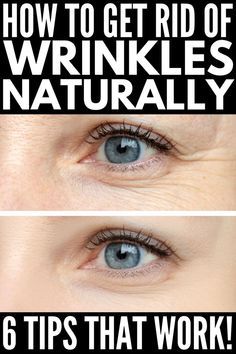 Hydrating Face Mask Diy, Wrinkles Remedies, Wrinkles Remedies Face, Pore Shrinking, Mouth Wrinkles, Wrinkles Hands, Get Rid Of Wrinkles, Antiaging Skincare, Eye Wrinkles