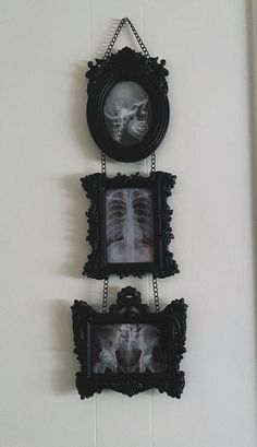 two framed pictures hang on the wall next to each other, with an x - ray in between them