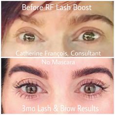 WOW! Check out Catherine's results from #lashboost. Lash Growth Cycle, Lash Lift Benefits, Eyelash Retention Tips, Benefits Of Lash Lift, Lash Boost Rodan And Fields