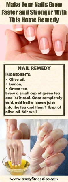 Nails Grow Faster, Nail Remedies, Longer Nails, Grow Nails Faster, Broken Nails, Nail Care Tips, How To Grow Nails, Essential Oils For Hair, Brittle Nails