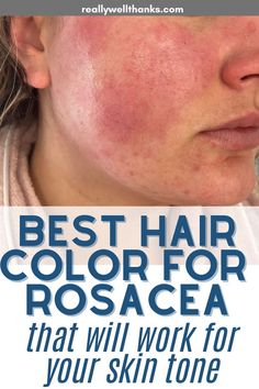 They call it a 'rosacea journey' for a reason -- it can take a long time to figure out your rosacea triggers and reduce facial redness. But you can use the right hair color to improve the appearance of your rosacea right away! Picking a color that suits your skin tone will improve how your skin looks and minimize facial redness. Rosacea is a long road but you can get relief right away by picking a hair color that goes with your color season! Soft Summer Makeup, Warm Hair Color, Growing Out Hair, Best Hair Color, Bold Hair Color, Fair Skin Tone, Healthy Hair Tips, Deep Skin, Long Road