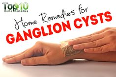 Home Remedies For Cysts, Water Retention Remedies, Teeth Remedies, Synovial Fluid, Cold And Cough Remedies, Sleep Remedies, Joints Pain Relief, Holistic Remedies