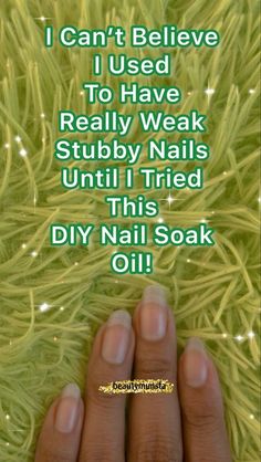 Strong Nails Diy, Long Strong Nails, Fingernail Health, Natural Beauty Hacks, Nail Remedies, Grow Long Nails, Nail Growth Tips, Love Nail Art, Pain Relief Remedies