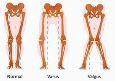 the muscles are labeled in three different ways