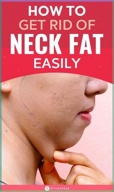 How To Get Rid Of Neck Fat Easily: Your neck tends to become heavier as you age or begin to put on weight. This can give your face a disproportionate appearance. Hence, to save you from this trouble and help you get rid of neck fat, here are some diet tips and exercises that may help. #Neck #NeckFat #Health #Fitness #Weightloss Double Chin Exercises, Chin Exercises, Put On Weight, Face Exercises, Double Chin, Lose 50 Pounds, Fish And Chips, Neck Pain