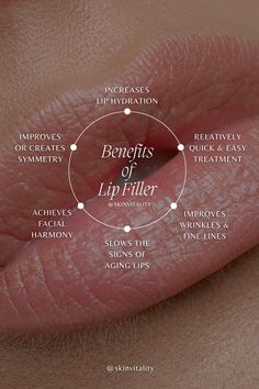 💋🌟Revitalize, Rejuvenate, Rebalance your lips: The Real Deal About Dermal Fillers! ❤️ Call (877) 346-6926 to book your appointment with a regulated Healthcare Professional 👨‍⚕️⚕️ Helping the most people look and feel beautiful in Canada since 1992 🖤 • • • • #juvederm #juvedermcanada #bodytransformation #dermalfiller #lipfiller #facialaesthetics #antiaging #nurseinjector #botoxtoronto #chinfiller #jawlinefiller #fillernearme #lipflip #lipfillertoronto Lip Filler Social Media, Botox Education, Lip Filler Aesthetic, Medspa Aesthetic, Glossy Aesthetic, Fillers Aesthetic, Filler Aesthetic