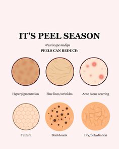 It’s officially chemical peel season🍂   Chemical peels are usually done in the fall and winter months because there is limited sun exposure. Some lighter peels can be performed in the summer but very limited❕   Chemical peels can help with;  1️⃣ hyperpigmentation  2️⃣ fine lines/wrinkles 3️⃣ acne/acne scarring  4️⃣ texture 5️⃣ blackheads  6️⃣ dry/dehydration   These are just a few skin conditions peels can help! There are many different peels to help the vast majority of skin concerns. . .  . . #fallskincare #fallskincaretips #skin #skincaretips #skintreatment #fyp #fypシ #esthetician #medspa #cosmeticclinic #chemicalpeel #chemicalpeels #aesthetician #pigmentation #aging #finelinesandwrinkles #blackheads #acne Esthetician Skin Analysis, Peel Season Esthetician, Chemical Peel Aesthetic, Chemical Peel Season, Esthetician School Notes, Chemical Peel Before And After, 90s Skincare, Peel Season, Ig Carousel