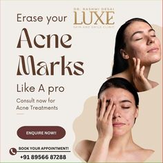 Transform your skin with our cutting-edge treatments for acne, scars, and pigmentation at Luxe Skin and Smile Clinic! Our expert team uses the latest technology to deliver results that last—without the worry of side effects. From personalized care plans to advanced techniques, we ensure your journey to clear, glowing skin is smooth and effective. ✨ Why choose us? ✅ Advanced, non-invasive treatments ✅ No side effects ✅ Long-term, visible results ✅ Expert-led care tailored to your skin Don’t... Insta Ads, Natural Wrinkle Remedies, Treatments For Acne, Permanent Makeup Studio, Skin Quotes, Stubborn Acne, Skin Facts, Skin Therapist