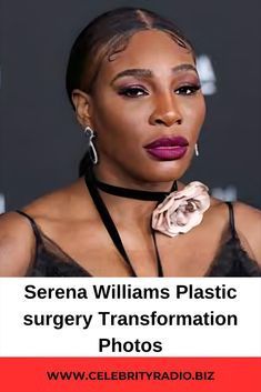 serena williams plastic surgery information photo posted on celebratoryradio biz