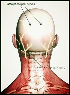 Occipital Headache, Occipital Neuralgia Exercises, Occipital Neuralgia Relief, How To Relieve Pinched Nerve In Neck, Occipital Neuralgia Symptoms, Intercostal Neuralgia, Cefaly Migraine, Neck Headache, Neck Muscle Anatomy