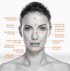 Botox Injection Sites, Botox Cosmetic, Cosmetic Injectables, Facial Aesthetics, Botox Fillers, Aesthetic Medicine, Botox Injections, Cosmetic Treatments, Medical Aesthetic