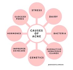 8 CAUSES OF ACNE. Although acne can be genetic, there are many other issues that cause breakouts. Read my complete article to learn the culprits of acne. #acne#pimples#hormones#oilyskin#dairy#stress Cause Of Acne, Causes Of Acne, Esthetician Quotes, Skincare Facts, Beauty Skin Quotes, Skin Facts, Esthetician Marketing, Skin Care Business, Skin Advice