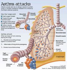 an image of asthma attacks in the body