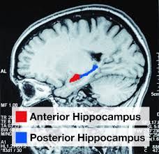 an mri scan shows the location of the hippocampus in the human brain