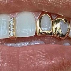 Pretty Teeth, Grillz Teeth, Teeth Caps, Gold Grill, Diamond Teeth, Dope Jewelry Accessories, Gold Grillz, Grills Teeth, Tooth Gem