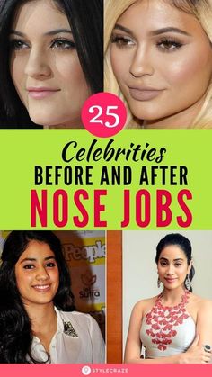 Bad Celebrity Plastic Surgery, Extreme Plastic Surgery, Celebrity Surgery, Cheek Implants, Plastic Surgery Fail, Nose Jobs, Hair Implants, Plastic Surgery Gone Wrong, Fashion Week Dresses