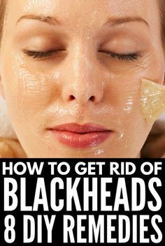 How To Tighten Your Neck Skin Naturally To Remove Blackheads, Rid Of Blackheads, Black Heads, Fall Makeup Looks, Diy Remedies, Winter Makeup, Acne Remedies