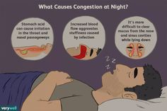 Find out why your congestion seems to get worse at night and what you can do to treat nighttime stuffiness. Drain Sinuses, Sinus Headache Relief, Nasal Congestion Relief, Sinus Drainage, Congestion Remedies, Sinus Cavities